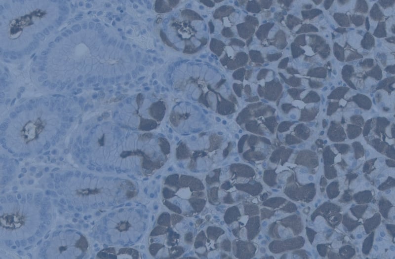 Your Biomarkers Don’t Exist in Isolation: Why Trends Matter More Than a Single Test