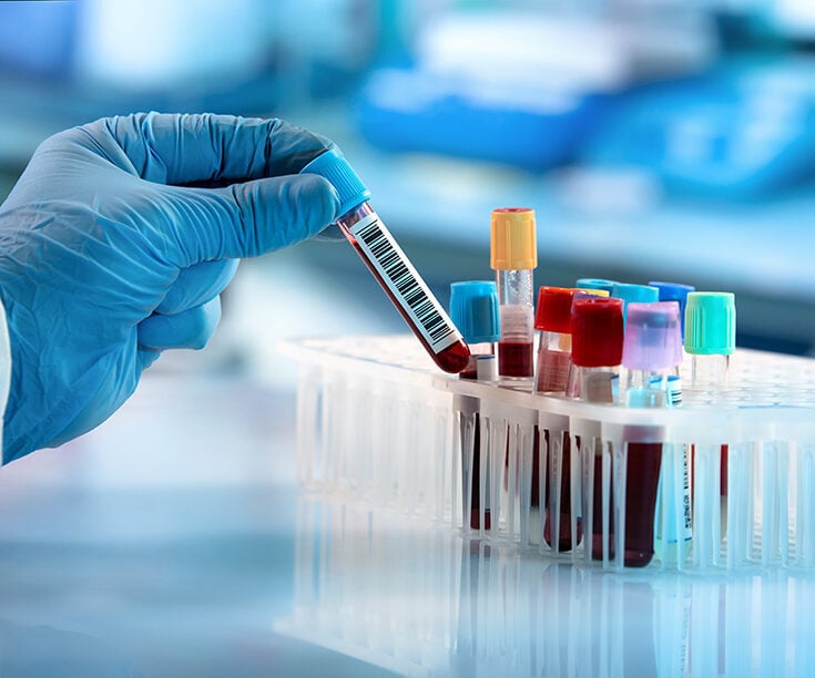 <span id="hs_cos_wrapper_name" class="hs_cos_wrapper hs_cos_wrapper_meta_field hs_cos_wrapper_type_text" style="" data-hs-cos-general-type="meta_field" data-hs-cos-type="text" >What Your Labs Can Tell You About Your Longevity Trajectory</span>